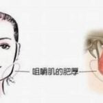 咀嚼肌